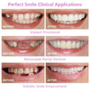 Nordic Smile™ - Transform Your Smile Quickly and Easily with Our Customizable Clip-on Veneers
